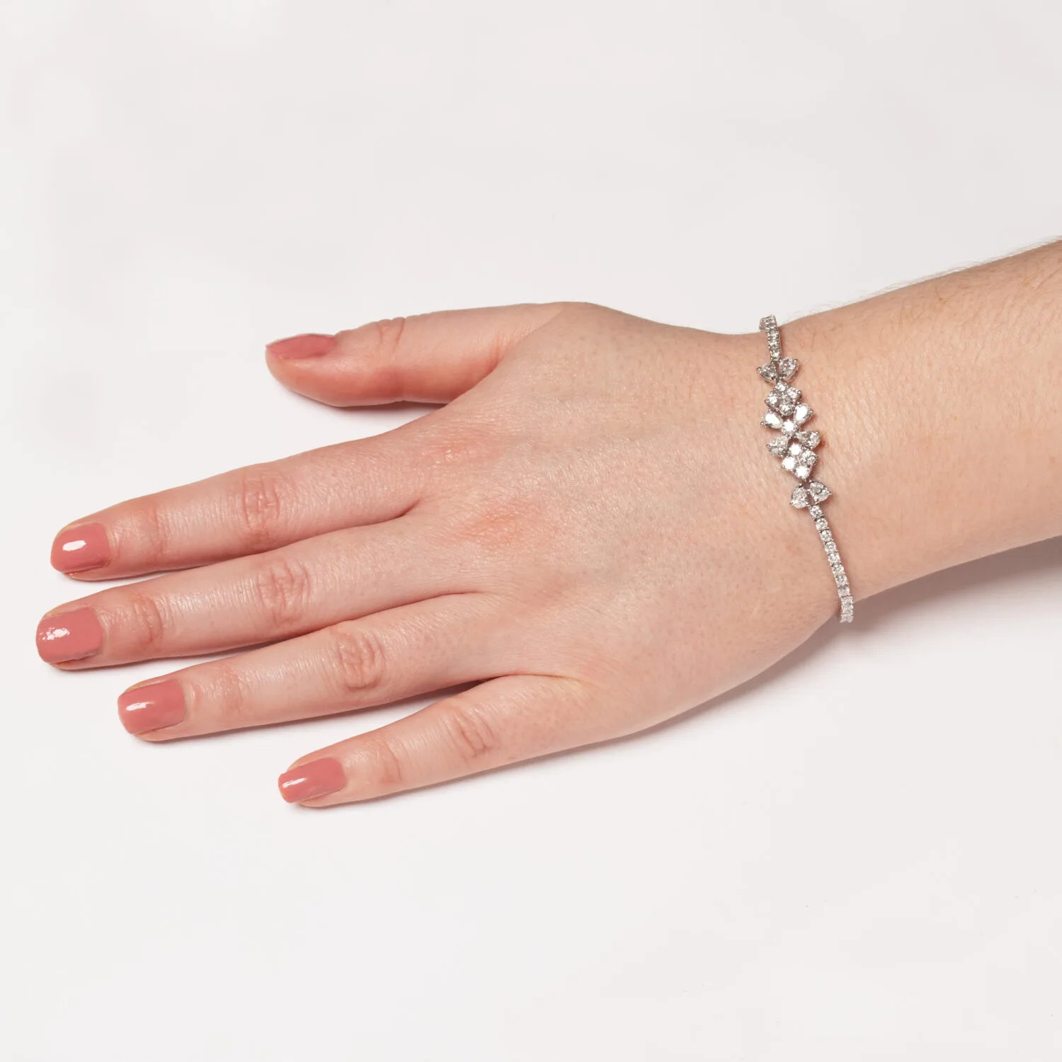 B559 WRIST